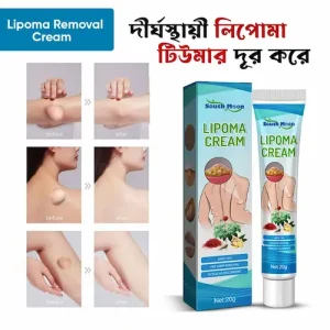 Lipoma treatment cream to reduce fatty lumps on skin - South Moon Lipoma Cream